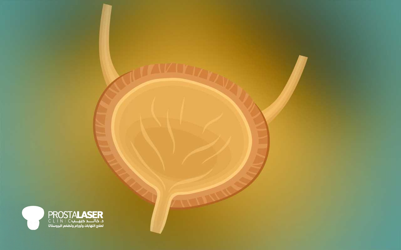 علاج سرطان المثانة