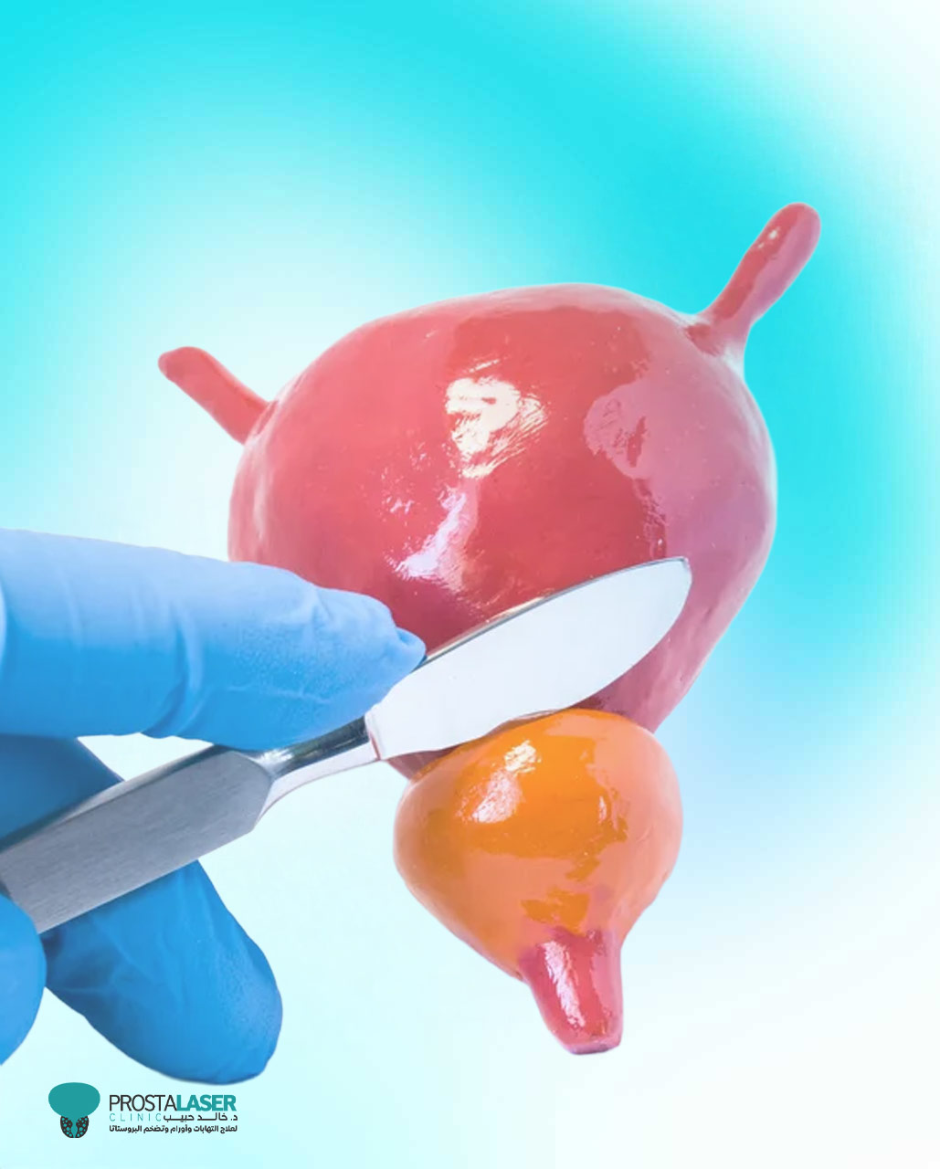 الآثار الجانبية بعد عملية استئصال البروستاتا