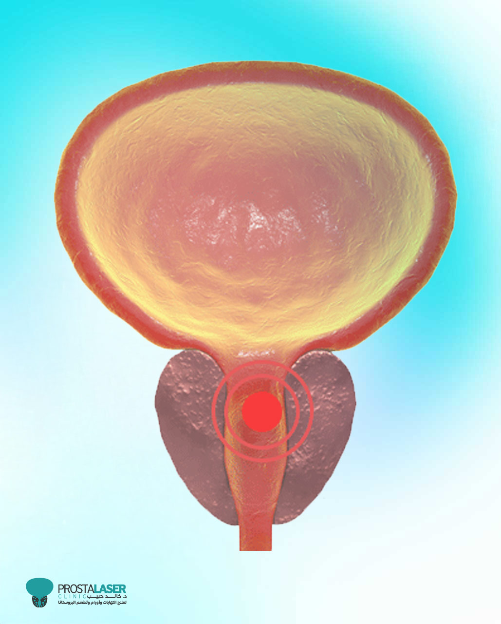 التهاب البروستات والجماع