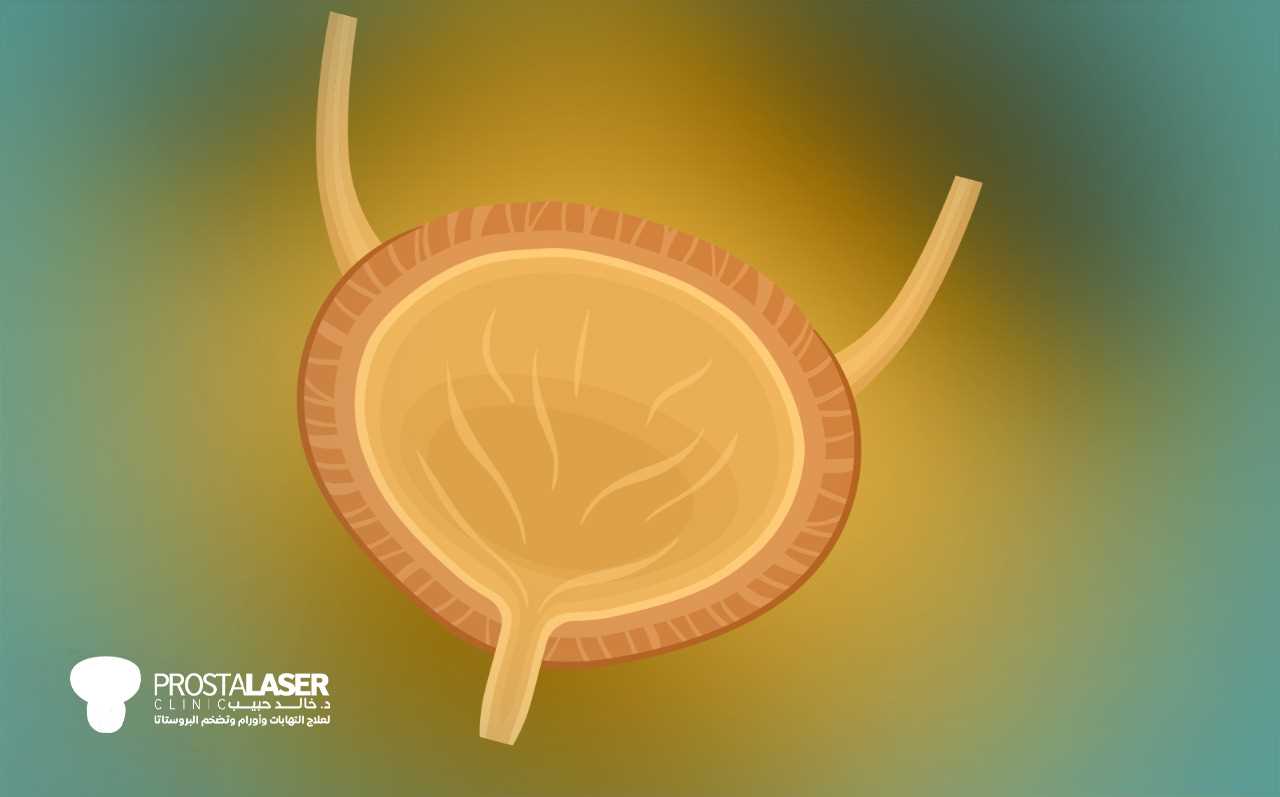 علاج سرطان المثانة